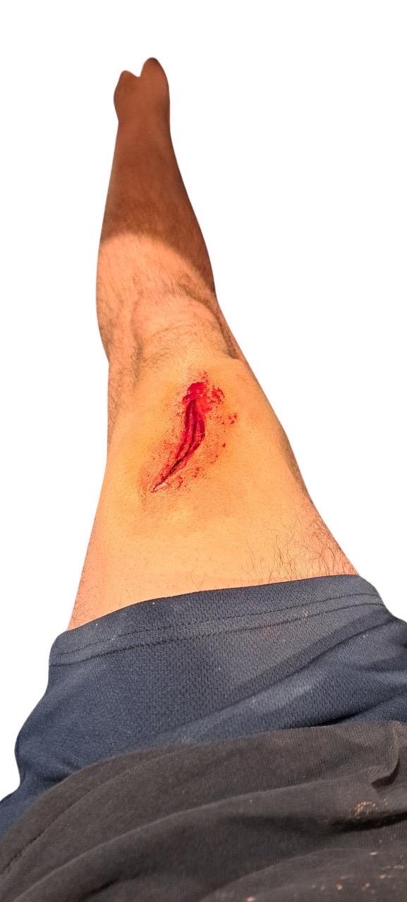 Realistic Latex Prosthetic Wound - Fresh Gash, Injury - Special Effects Makeup Prop for Halloween, Cosplay, Film & Theater