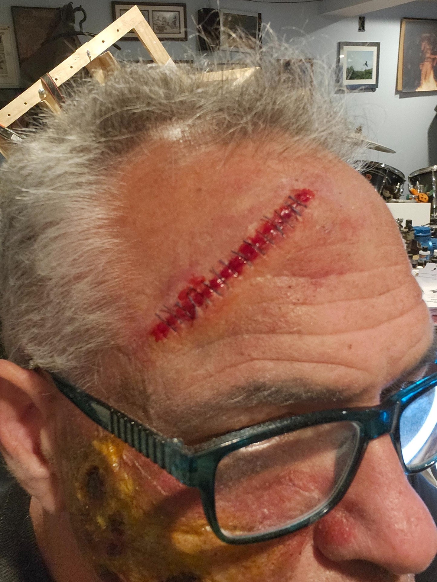 Homemade Stitches Pro's Aide Special Effects Makeup Prosthetic - Elevate Your Cosplay & Halloween Looks!