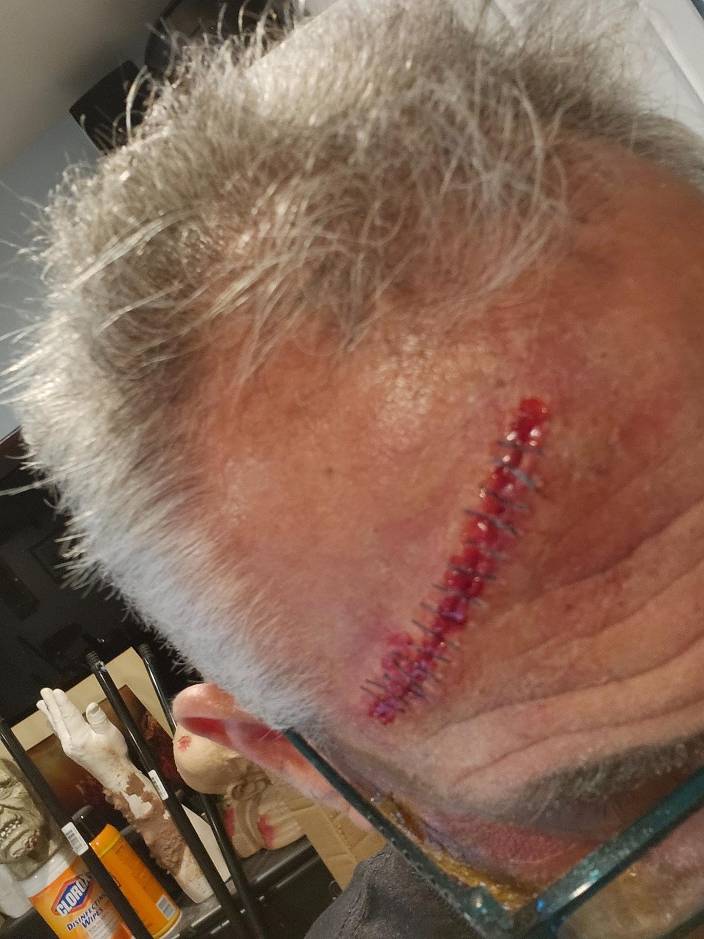 Homemade Stitches Pro's Aide Special Effects Makeup Prosthetic - Elevate Your Cosplay & Halloween Looks!