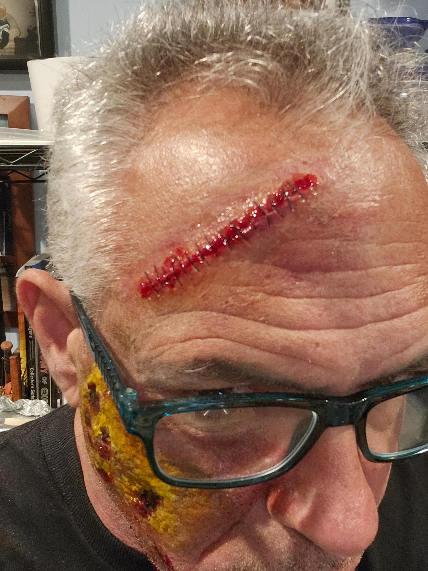Homemade Stitches Pro's Aide Special Effects Makeup Prosthetic - Elevate Your Cosplay & Halloween Looks!
