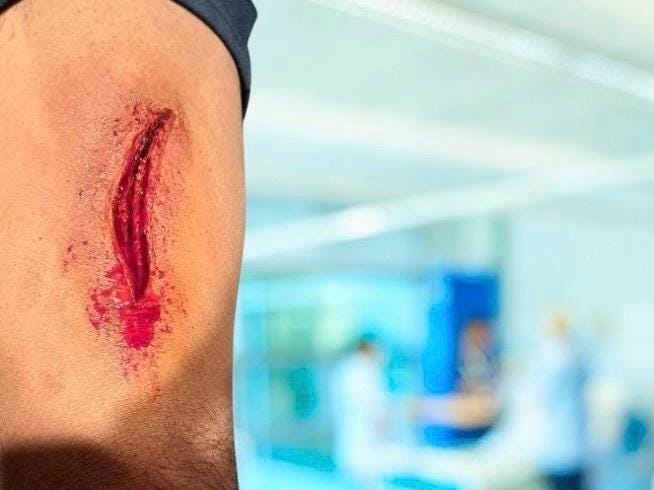 Realistic Latex Prosthetic Wound - Fresh Gash, Injury - Special Effects Makeup Prop for Halloween, Cosplay, Film & Theater